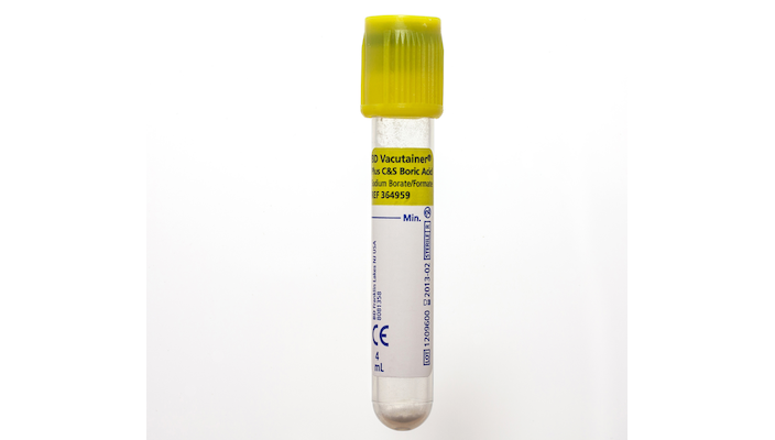 glass plasma ESR tube, urine specimen kit, C&S Boric Acid
