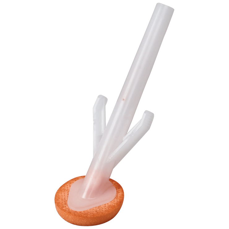 BD ChloraPrep™ Applicators with Sterile Solution 930415 BD